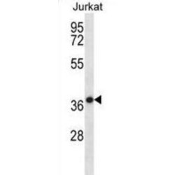 Heat Shock Protein-Binding Protein 1 (HSPBP1) Antibody