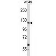 Insulin Receptor Related Receptor (INSRR) Antibody