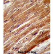 Mitogen-Activated Protein Kinase Kinase Kinase 4 (MEKK4) Antibody
