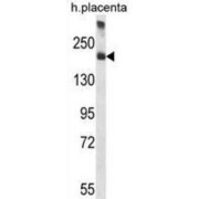 Alpha-2-Macroglobulin (A2M) Antibody