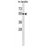WW Domain-Containing Oxidoreductase (WWOX) Antibody