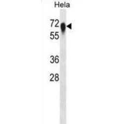 Complement Decay-Accelerating Factor (CD55) Antibody