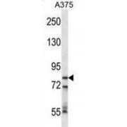 Cleavage And Polyadenylation Specificity Factor Subunit 3 (CPSF3) Antibody