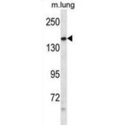 abx028322