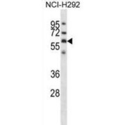 Glypican 3 (GPC3) Antibody