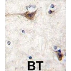Cadherin 10 (CDH10) Antibody
