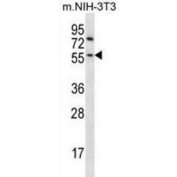 Glycogen Synthase Kinase 3 Beta (Gsk3b) Antibody