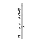 WB analysis of 293 cell line lysates.