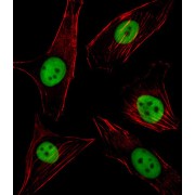 Spleen Focus Forming Virus Proviral Integration Oncogene (SPI1) Antibody