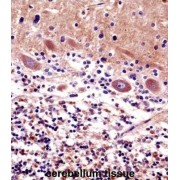 Cerebellar Degeneration-Related Protein 2 (CDR2) Antibody