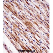 Nuclear Receptor Subfamily 1 Group D Member 2 (NR1D2) Antibody