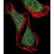 ECSIT Homolog (Drosophila) (ECSIT) Antibody