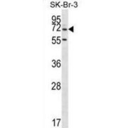 Zinc Finger Protein 398 (ZNF398) Antibody