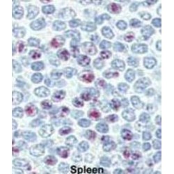 Lin-28 Homolog B (LIN28B) Antibody