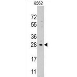 Lin-28 Homolog B (LIN28B) Antibody