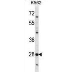 Serine Protease 27 (PRSS27) Antibody