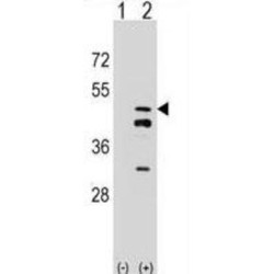 Farnesyl Diphosphate Synthase (FDPS) Antibody