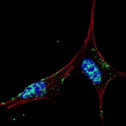 Homeobox Protein NANOG (NANOG) Antibody