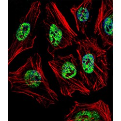 Homeobox Protein NANOG (NANOG) Antibody