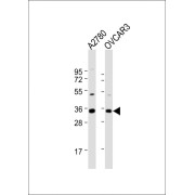 WB analysis of extracts of A2780 (Lane 1) and OVCAR3 (Lane 2) whole cell lysates Lysates/proteins at 20 µg per lane, using NANOG Antibody (1/1000 dilution) and Goat anti-Rabbit IgG (H+L) secondary antibody. Predicted band size: 35 kDa.