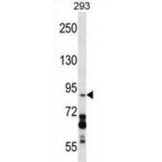 DEAD-Box Helicase 20 (DDX20) Antibody
