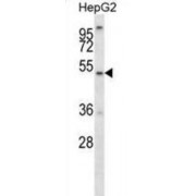 ALG11, Alpha-1,2-Mannosyltransferase (ALG11) Antibody