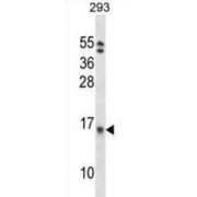Eukaryotic Translation Initiation Factor 1B (EIF1B) Antibody