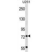 Tripartite Motif-Containing Protein 2 (TRIM2) Antibody