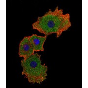 Mothers Against Decapentaplegic Homolog 9 (SMAD9) Antibody