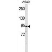 Plakophilin-3 (PKP3) Antibody