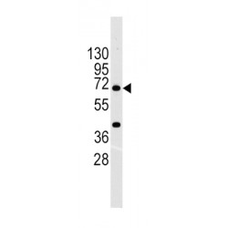 Broad Substrate Specificity ATP-Binding Cassette Transporter ABCG2 (ABCG2) Antibody