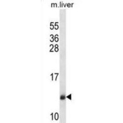 Sec61 Translocon Beta Subunit (SEC61B) Antibody