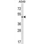 abx028412