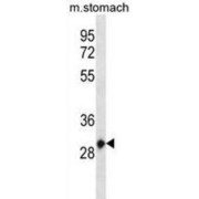 Homeobox Protein Hox-C12 (HOXC12) Antibody