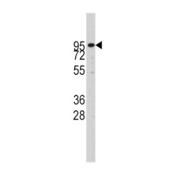 ADAM Metallopeptidase Domain 17 (ADAM17) Antibody