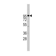 ADAM Metallopeptidase Domain 17 (ADAM17) Antibody