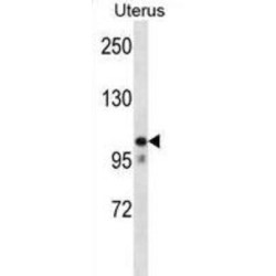 Mov10 RISC Complex RNA Helicase (MOV10) Antibody