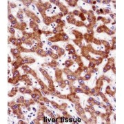 Indian Hedgehog Protein (IHH) Antibody