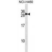 Protein S100-B (S100B) Antibody