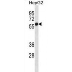 Alkaline Phosphatase, Placental Type (ALPP) Antibody