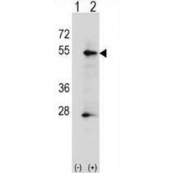Alkaline Phosphatase, Placental Type (ALPP) Antibody