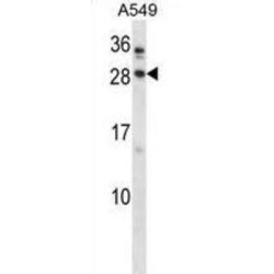 Homeobox Protein BarH-Like 1 (BARX1) Antibody