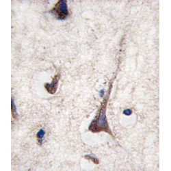 T-Cell Surface Glycoprotein CD3 Gamma Chain (CD3G) Antibody