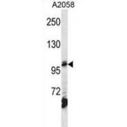 AP-2 Complex Subunit Beta (AP2B1) Antibody