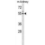 WB analysis of mouse kidney tissue (35 µg).