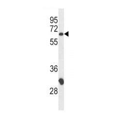 T-Cell Surface Glycoprotein CD4 (CD4) Antibody