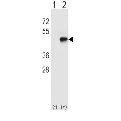 T-Cell Surface Glycoprotein CD4 (CD4) Antibody