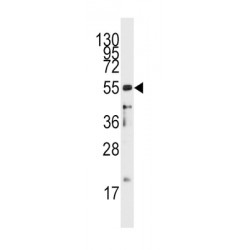 T-Cell Surface Glycoprotein CD4 (CD4) Antibody