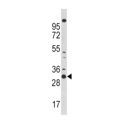 Cyclin-Dependent Kinase 1 (CDK1) Antibody