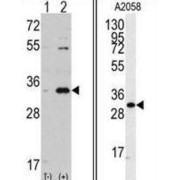 Cyclin-Dependent Kinase 1 (CDK1) Antibody